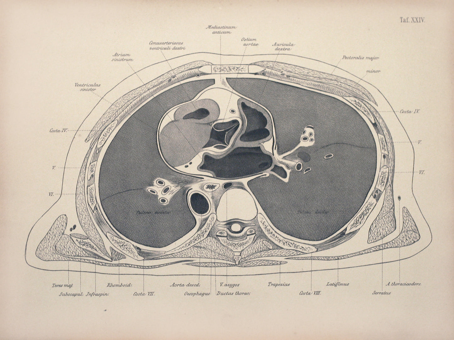 Plate XXIV—Lungs